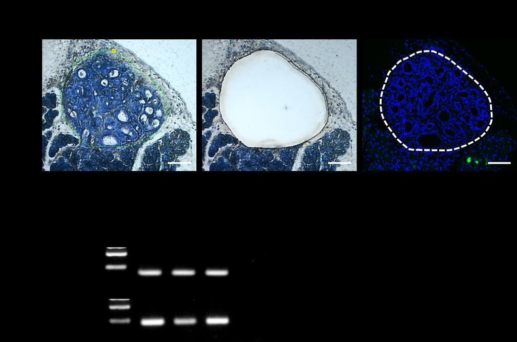 Supplementary Figure 4 Supplementary Figure 4 RT-PCR analysis of PanIN cells from Gdeg mice.