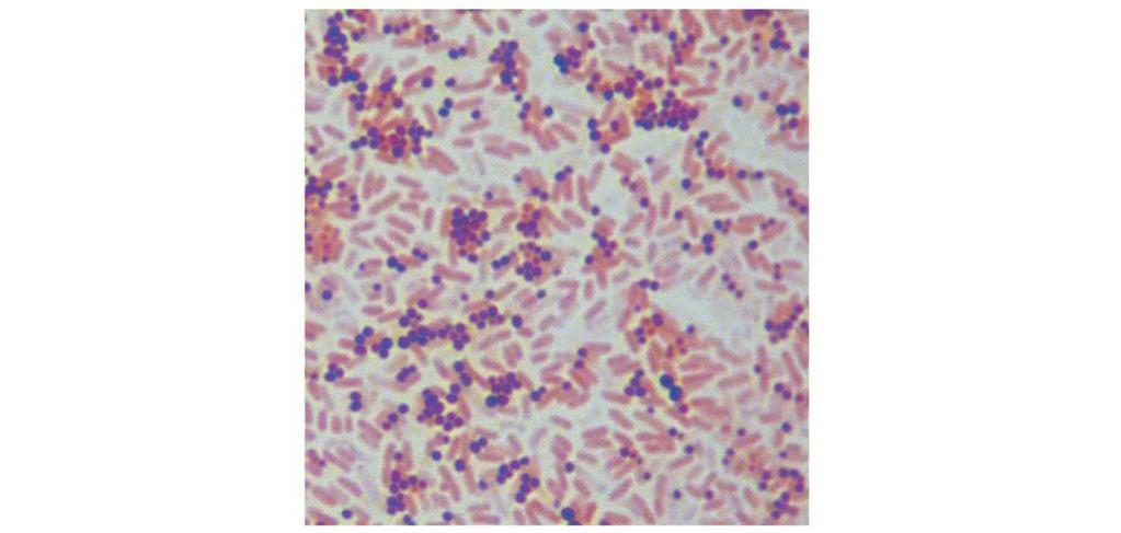 Gram Staining A Gram stain is a very common stain to distinguish 2 bacterial types: