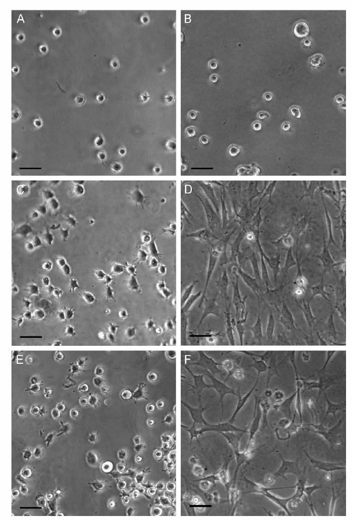 Smooth muscle cells (SMCs) adhering to PEGylated protein hydrogels: PEG-Albumin: no adhesive sites no cell spreading