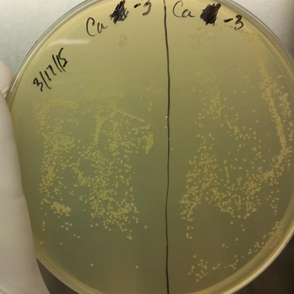 Candida Albicans Candida Albicans is a diploid fungus that grows both as yeast and filamentous cells and a causal agent of opportunistic oral and genital infections in humans, and candidal