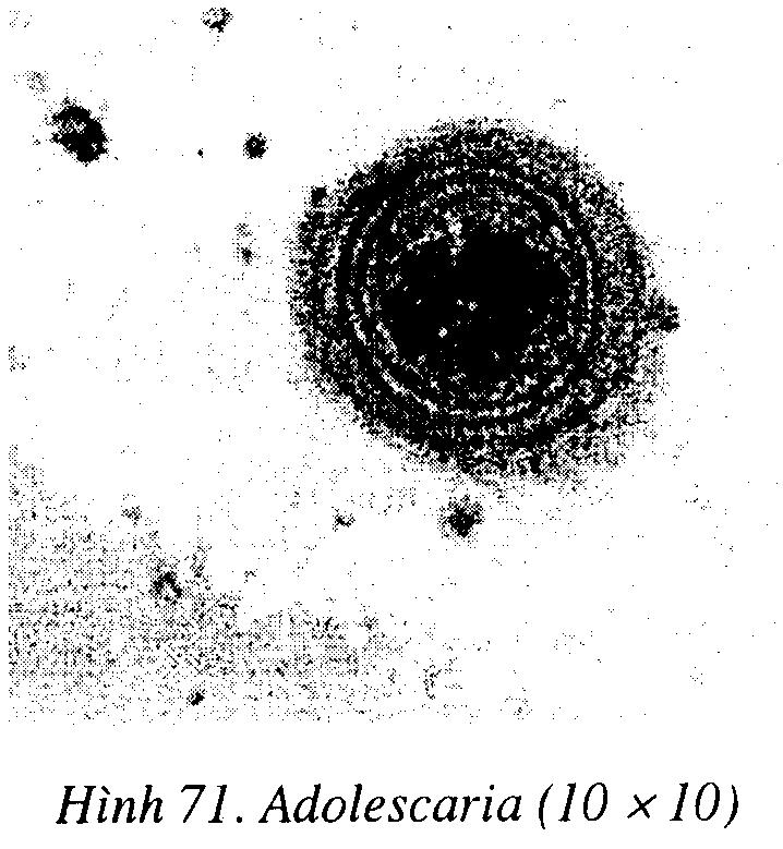 Redia con có hình bán nguyệt uốn khúc, bên trong có chứa các Cercaria đã thành thục. - Cercaria Cercaria được hình thành trong gan ốc sau 28-36 ngày (Graczick, J. K và cs, 1982).