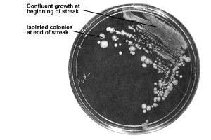 The goal: isolated colonies for further purification C.