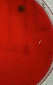 hemolysins Partial clearing and greening of blood = Alpha-hemolysis, positive for degradation of
