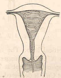 IUCDs prevent pregnancy by making the endometrium unreceptive to the fertilized ovum.
