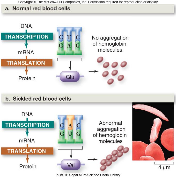Most forms of sickle cell are a one amino acid change caused by a single base