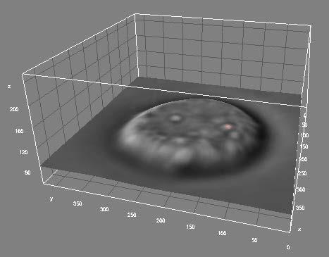 (B) Three-dimensional reconstruction of the confocal Z-axis imaging