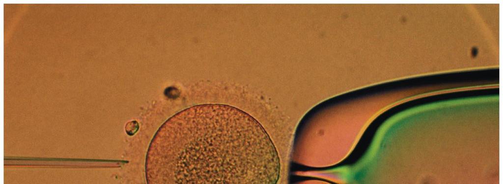 Figure 9.7 The microinjection of foreign DNA into an egg. Figure 9.
