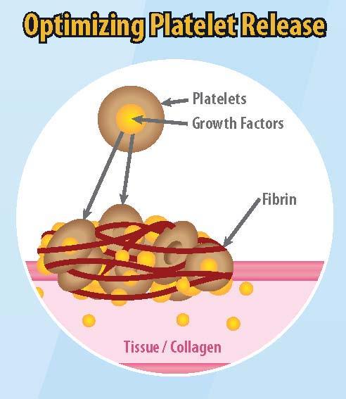 ProTec Features and Benefits ProTec will form a protective fibrin matrix in vivo following injection: Fibrinogen in plasma forms fibrin fibrin is released following