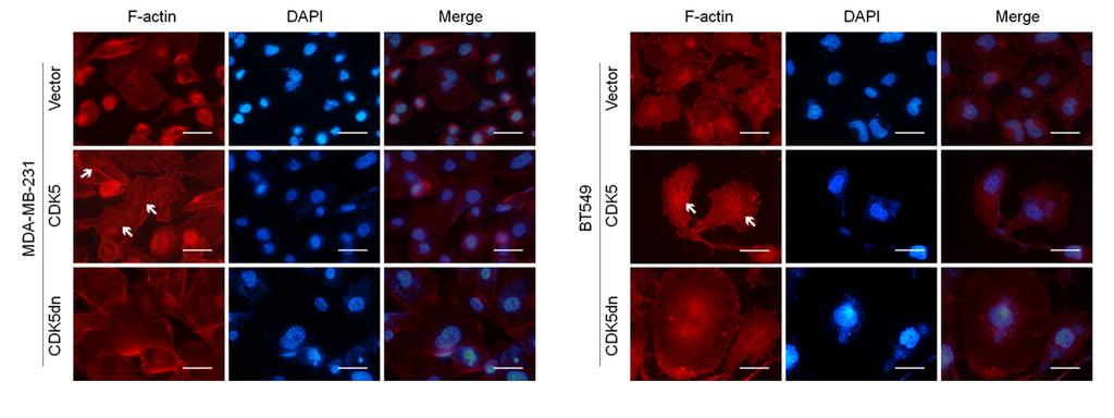 (b) immunoblotting analysis of expression of CDK5, FAK and p-fak S732 in MDA-MB-231 (left) and BT549 (right) cells after infection of CDK5, CDK5dn or empty vector.
