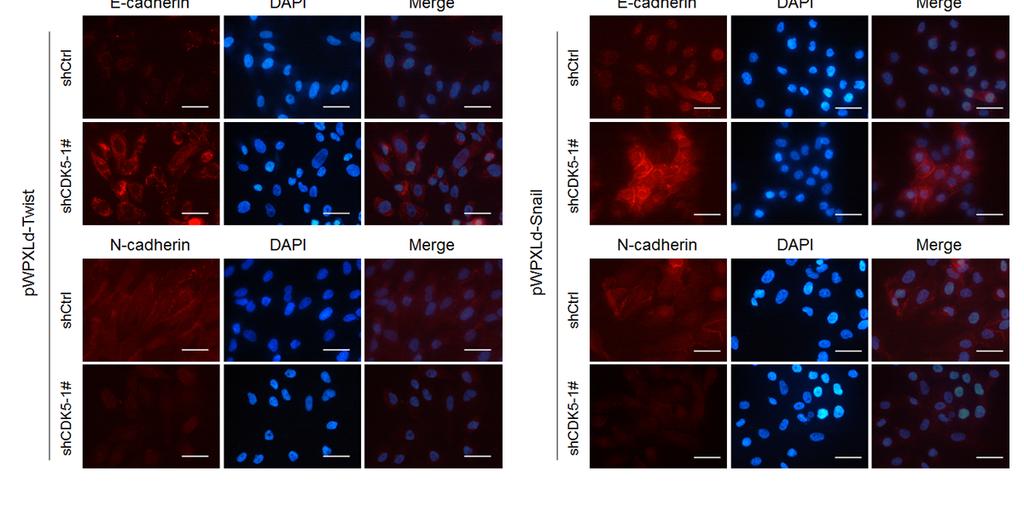 (b) immunoblotting analysis of the expression of CDK5 and the epithelial marker