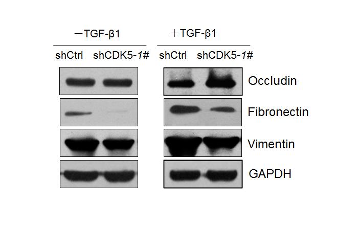 Figure S2. Knockdown of CDK5 inhibited TGF-β1-induced EMT.