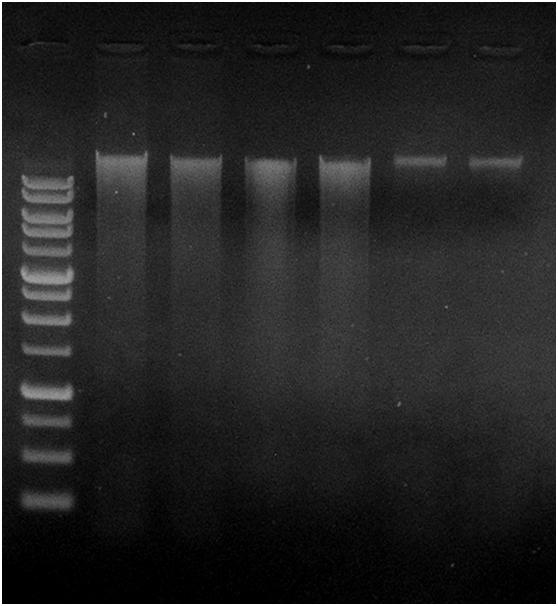 10 µl aliquots of purified DNA from 100 µl eluates were analyzed on a 0.8% agarose gel.