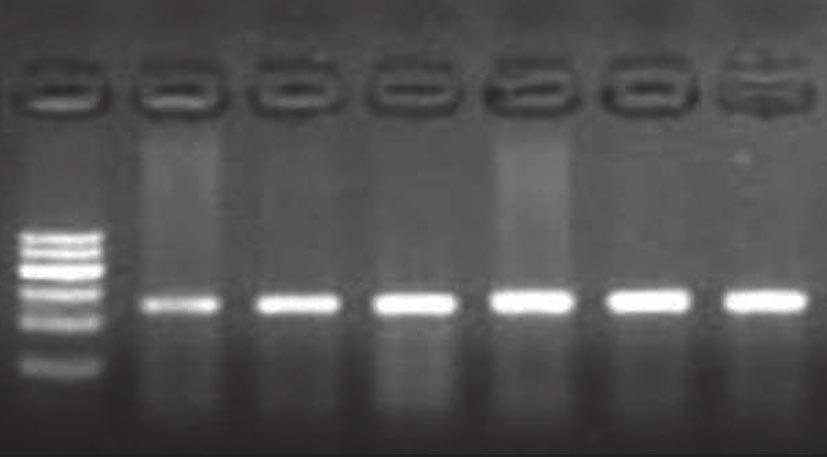RT-PCR Product TIANScript M-MLV Reverse Transcription of 500 ng to 5 µg RNA per Reaction TIANScript M-MLV Reverse Transcriptase is an RNA-dependent DNA polymerase that can