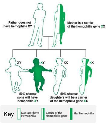 Causes Clinical Manifestations Genetic disorder Recessive trait Located on X chromosome Females can be carriers Mutation with clotting proteins Hemophilia can result in: Bleeding within joints