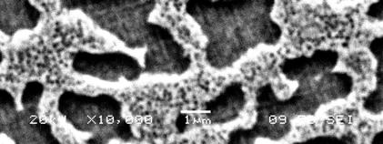 Those precipitates that did not dissolve coarsened during the heat treatment, as shown in the magnified image of interdentritic primary in Figure