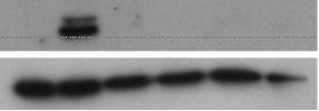 Figure S4 EML Cells EML Del 417-419 insy D 816 I SCF -