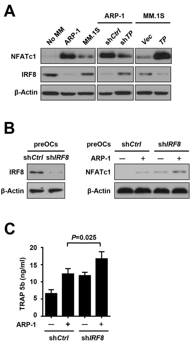 Fig. S3. Myeloma-expressed TP enhances NFATc1 expression and activity through inhibition of IRF8. (A) PreOCs were co-cultured without or with myeloma cells ARP-1, MM.