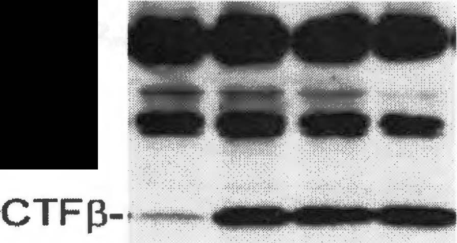 5 µm DAPT were analyzed by Western blot for the expression of PSl(top panel) using anti-psln, which is specific for the
