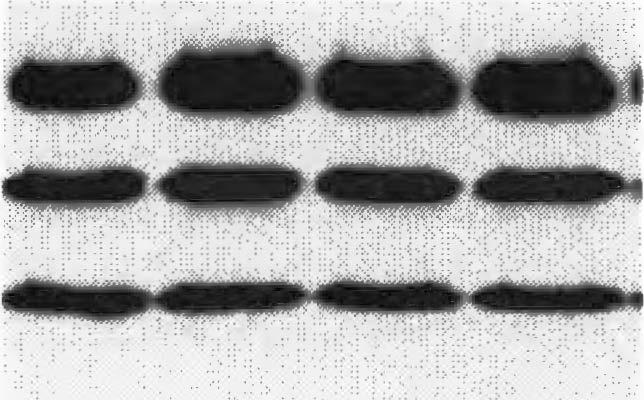 Full-length APP, CTF, and A 46 in the cell lysate were detected by 6E10 (middle panel).