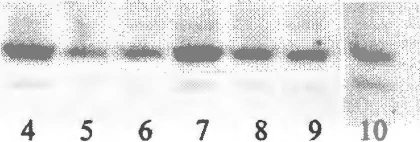 B: Lysates were separated on 10/18 SDS PAGE and probed with C15