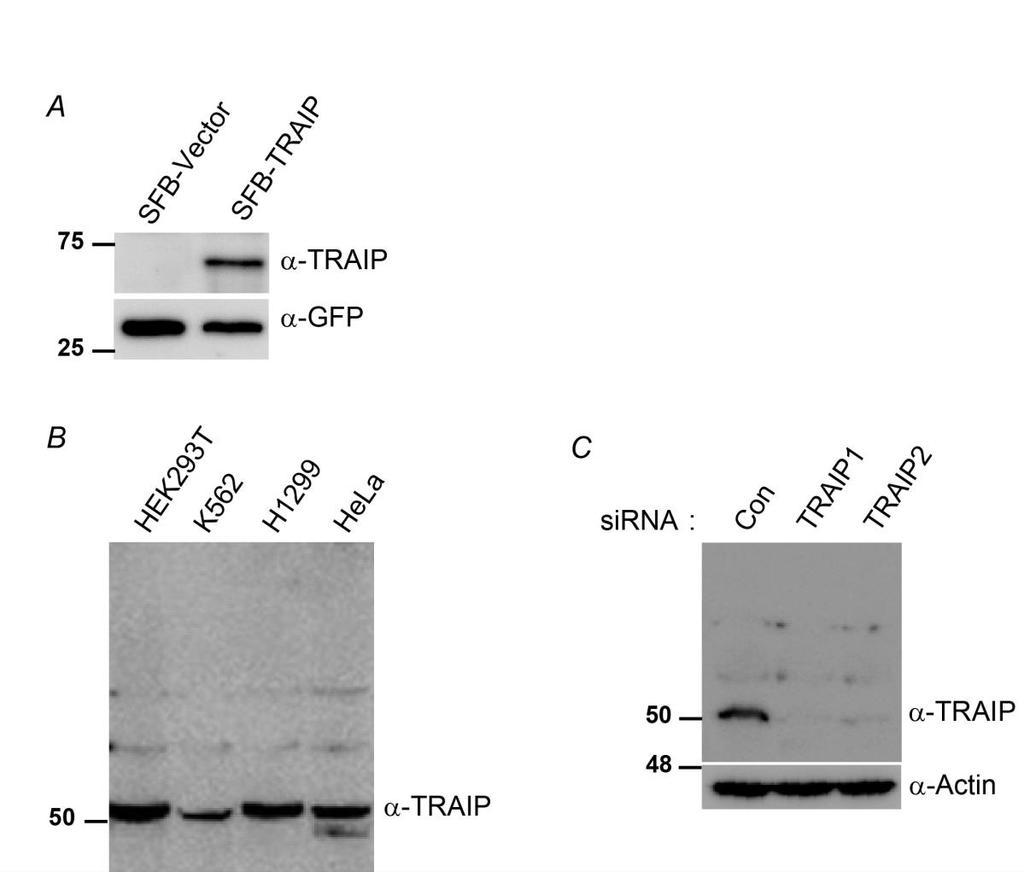 Supplementary Fig. 2. In-house TRAIP Antibody specificity. (A) In-house TRAIP antibody detects overexpressed TRAIP. SFB-Vector and SFB-TRAIP expression vector were transfected in HEK293T cells.