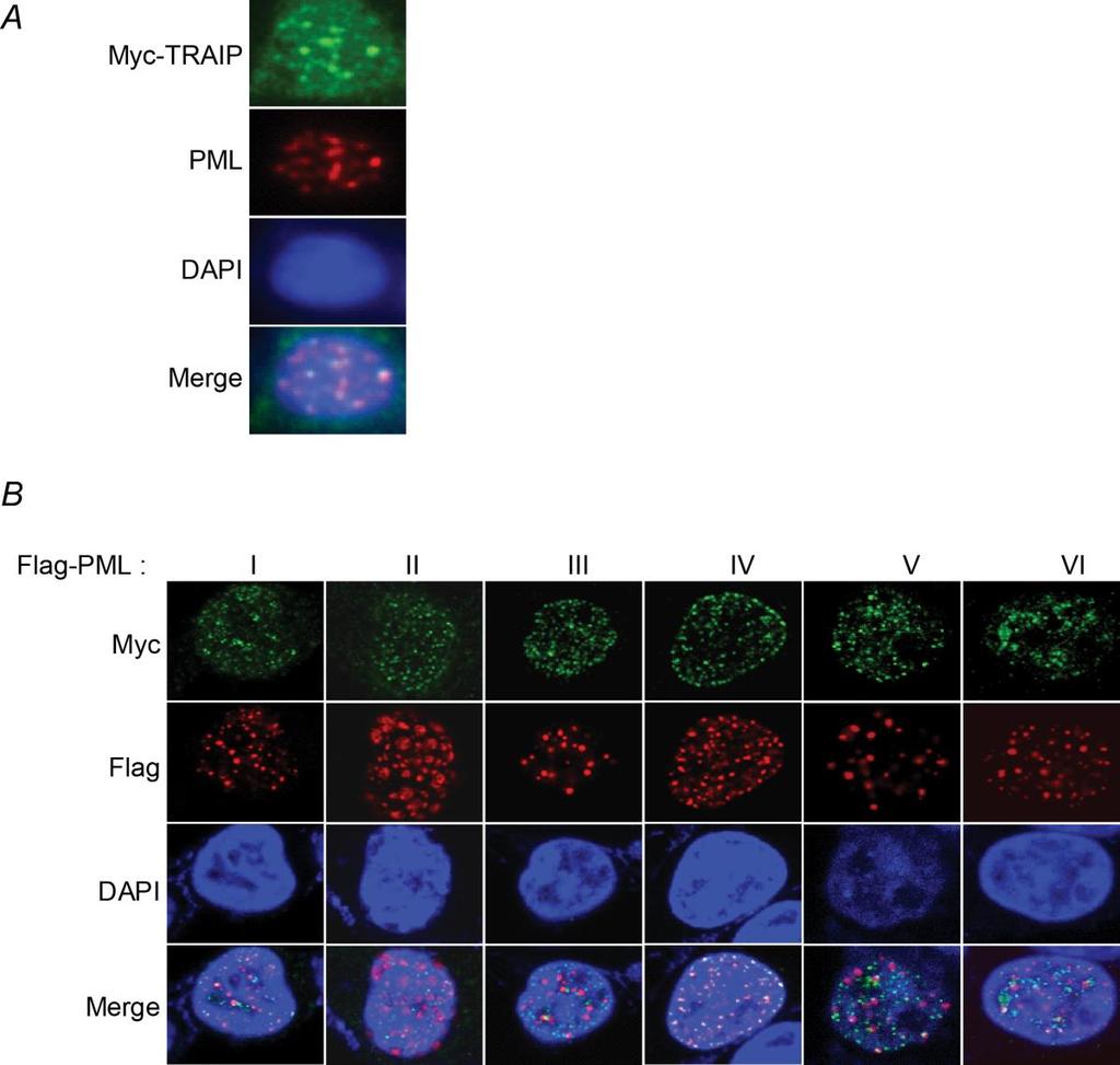 Supplementary Fig. 4. TRAIP foci were found in PML bodies in the absence of DNA damage (A) 293T cells were transfected with the Myc-TRAIP expression vector.