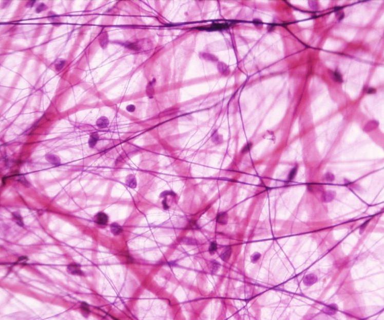 Connective tissue Consists mostly of fibers and ground substances, with widely separated cells.