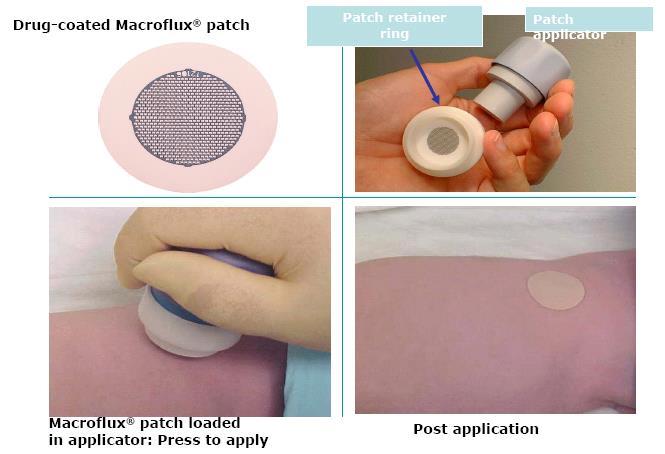Transdermal Microneedles Patch Application is