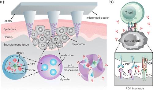 Recent Development of Microneedles Schematic of the MN patch-assisted delivery of apd1 for the skin cancer treatment.