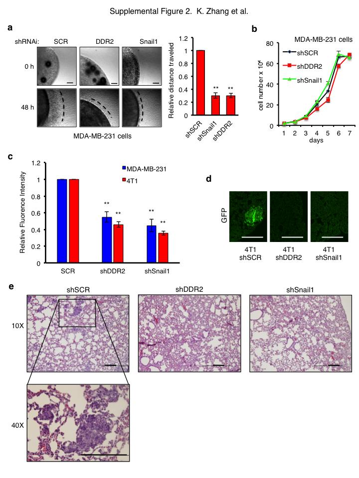 Figure S2 influences breast cancer cell migration and invasion in vitro and metastases in vivo.