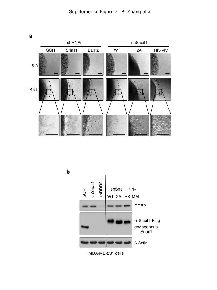Figure S7 shrnai depletion and rescue in MDA-MB-231 cells. (a) MDA-MB-231 cells were depleted of or or control (SCR) with shrnai (left three panels).