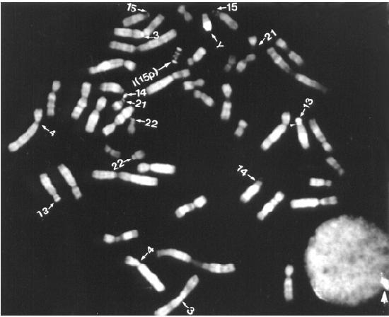2. Banding of chromosome Q bands: Caspersson (1970)