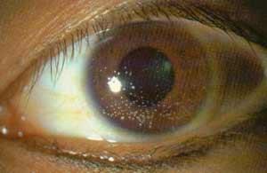 eye, including its