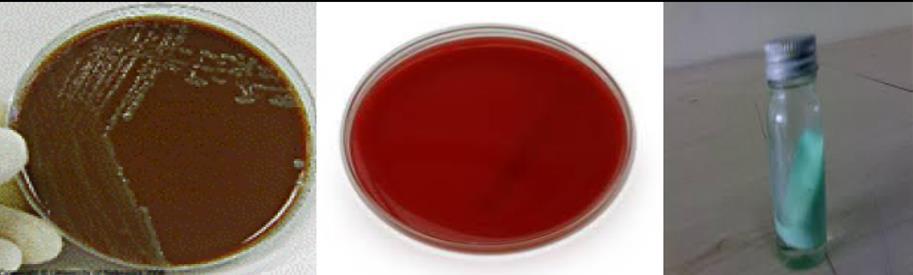 II. Enriched media By adding blood, serum or egg, e.g. blood agar, chocolate agar, Lowenstein-Jensen media*. *it s used to identify Mycobacterium tuberculosis, and it contains malachite green. III.