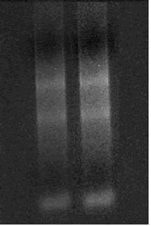 Application of PCR in Research Project การใช เทคน ค Differential display RT-PCR เพ อศ กษาการ เปล ยนแปลงการแสดงออกของย น Total rrna extraction 28s rrna 18s rrna ร ปท 1