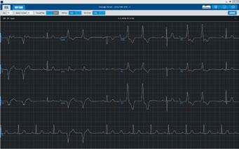 capture it in the ECG test with a simple click of the mouse.