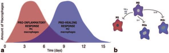 2 The Role of Macrophages in the Foreign Body Response to Implanted 25 Fig. 2.3 Macrophages in normal wound healing.