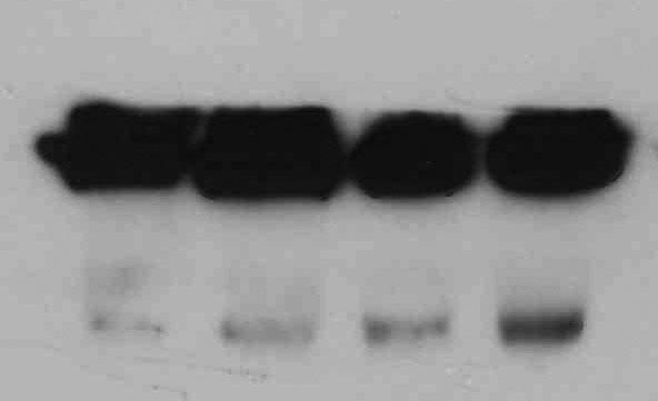 Fig. 6 Gly- 531-1μg 0.2μg 1μg Bcl-xL Bcl-xS Tubulin Anti-Flag Fig. 6. Detection of Bcl-xL and Bcl-xS protein in same Western blot after the ESF transfection.