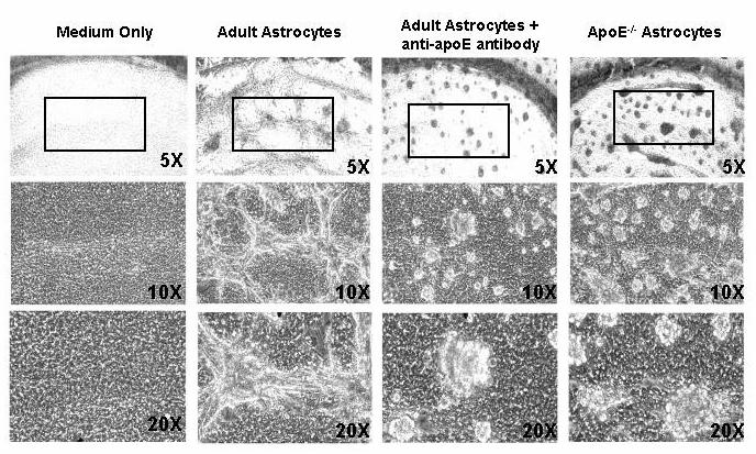 Multicellular Astrocyte Aggregates Form in Response to Aβ