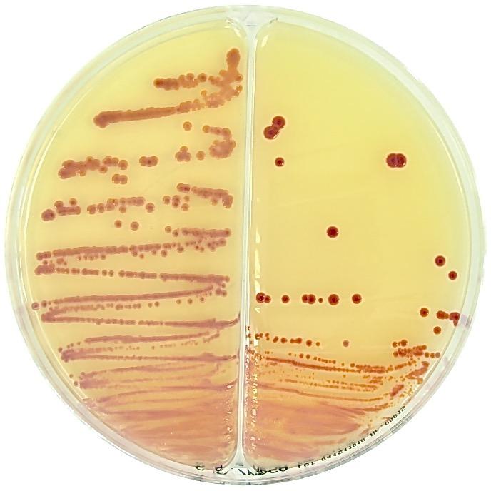 Liofilchem s.r.l. eady culture media in two sectors petri dishes Baird Parker / acconkey Selective media for Staphylococcus aureus and gram-negatives isolation.