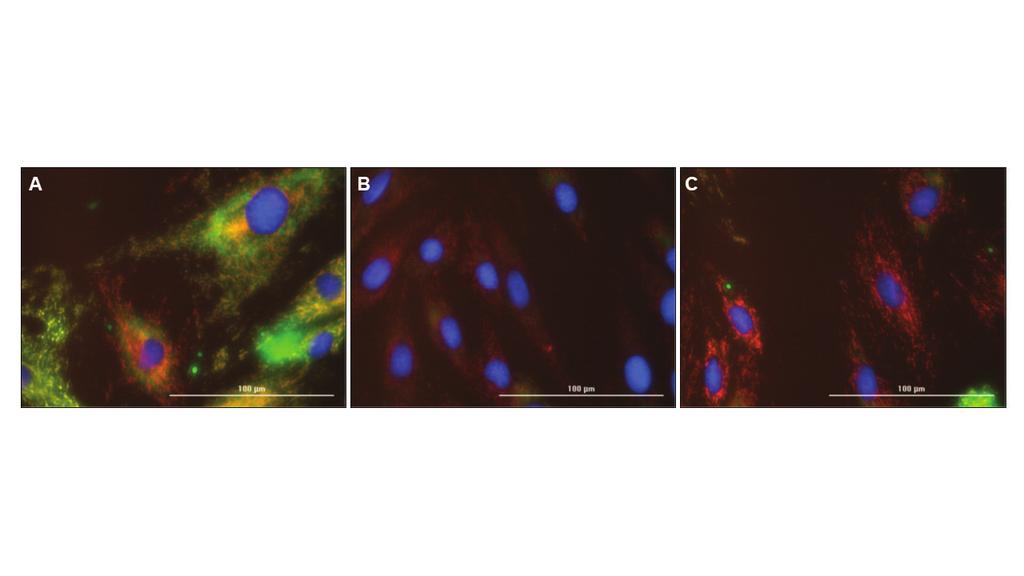 Fluorescence Microscopy RESOURCES Appendix Figure 2. H9C2 cells treated with vehicle, FCCP or Calcein Quenching Control.