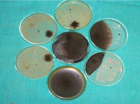 viride and T. harzianum was found most effective and recorded 19.00 mm mean colony diameter and 78.88 per cent inhibition of the test pathogen followed by T. hamatum (77.045%), yeast (40.37%), P.