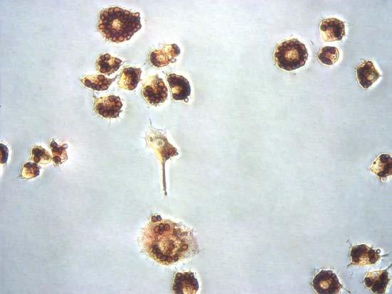 Figure 3. Zymosan Particles Engulfment by Raw 264.7 Macrophage. References 1. Sansonetti, P. (2001) Semin. Immunol. 13:381 390. 2. Jutras I and Desjardins M. (2005) Annu Rev Cell Dev Biol. 21:511-27.