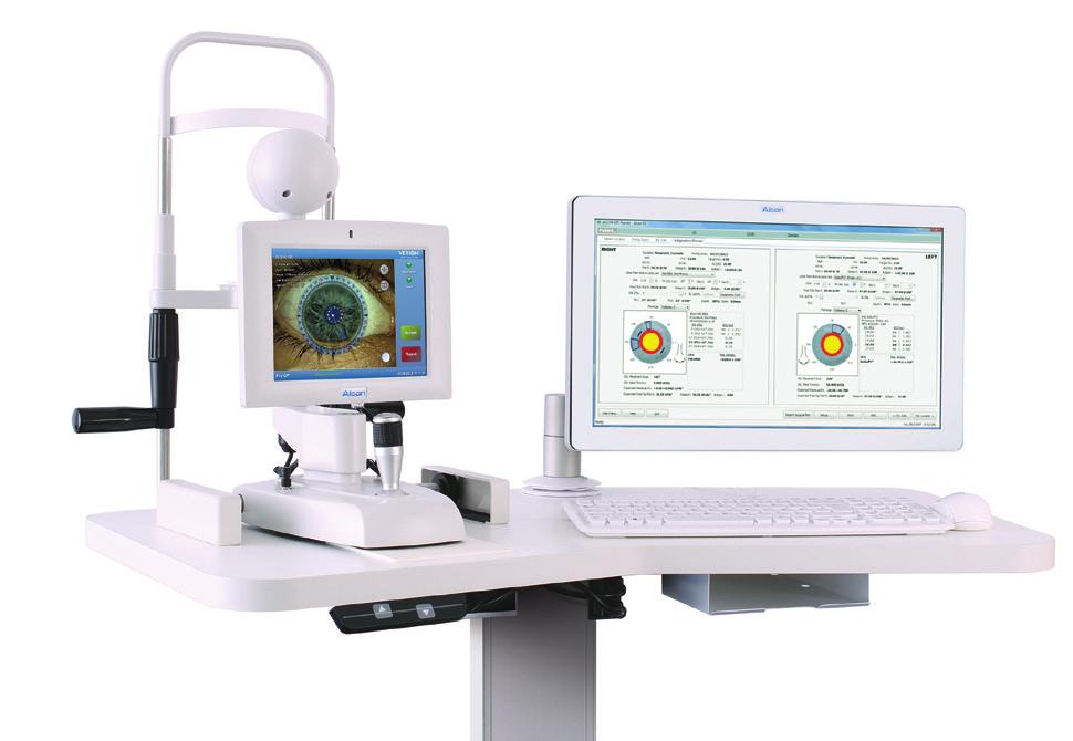 THE ACRYSOF IQ TORIC IOL Astigmatism Management: Streamlining the Process How the new VERION Image Guided System helps to enhance surgery with the AcrySof IQ Toric IOL. BY MICHAEL P.