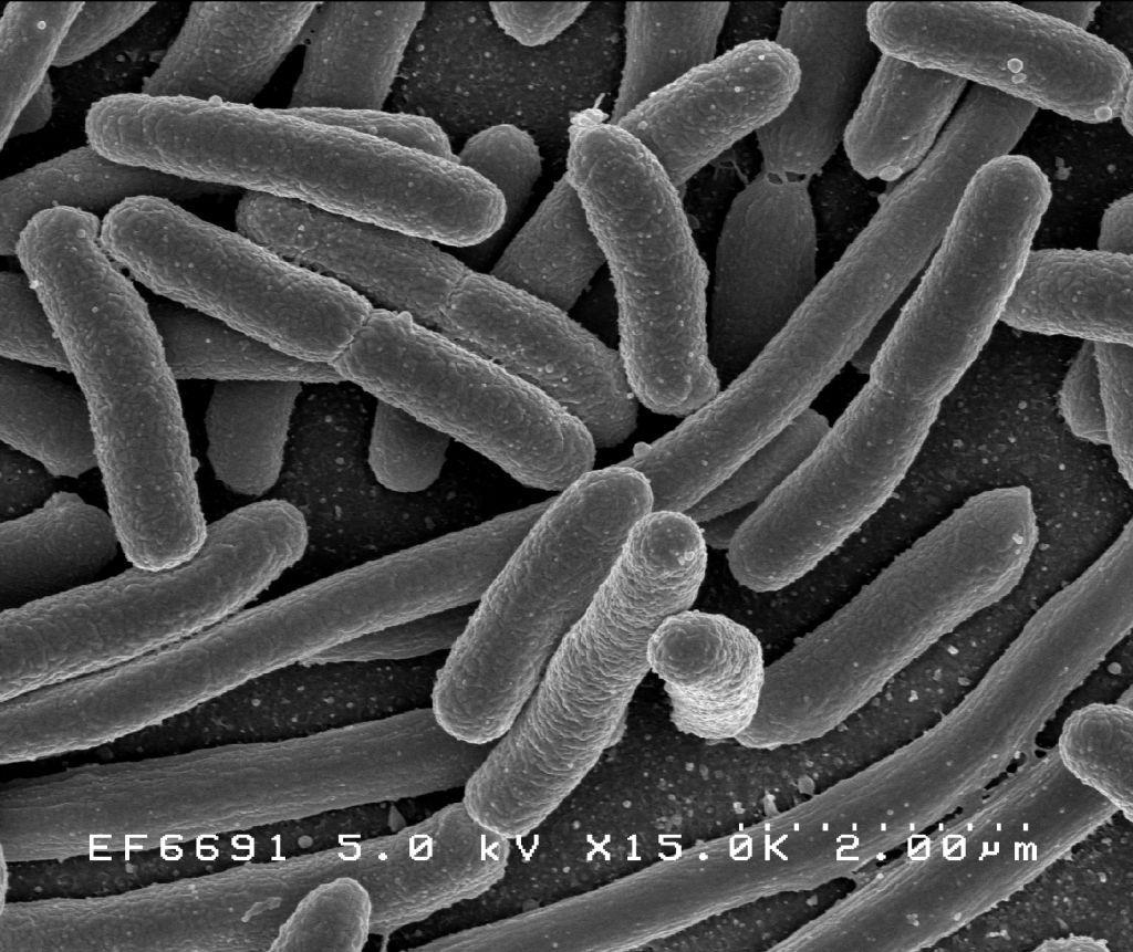 Escherichia coli Inhabit intestinal tract Many different types Many are not