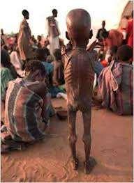 Malnutrition is a disorder of nutrition that results when a person that are needed by the human body.