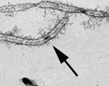 Prophase 1 Synaptonemal Complex chromatin protein chromosome recomb nodule recombination DG Peterson http://www.msstate.edu/research/mgel/meiosis.htm ch.