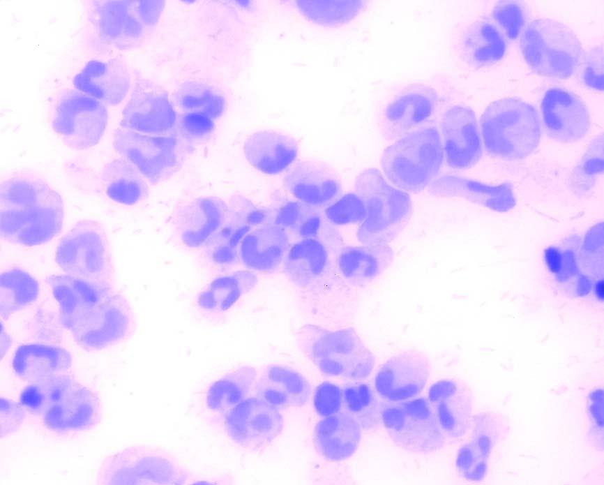 cells after 72h of treatment with or isotype control mab (control).