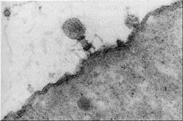 Bacterial Phage: T4