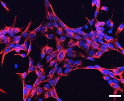 fibroblasts Use cellular